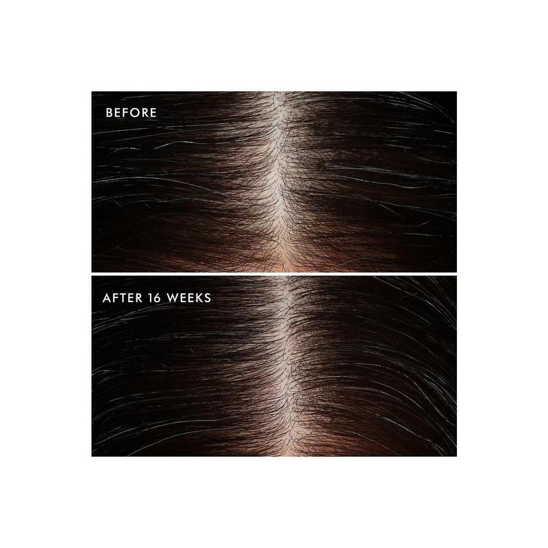 Moroccanoil Revitalizing Scalp Tonic Treatment
