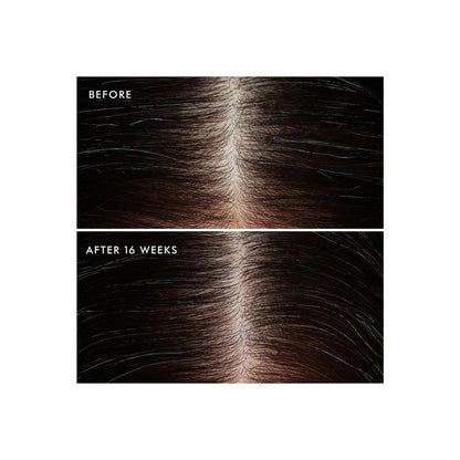 Moroccanoil Revitalizing Scalp Tonic Treatment